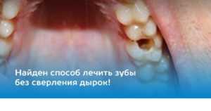 Лікування карієсу без болю в Києві на Позняках