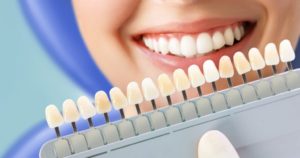 Відбілювання зубів та лікування карієсу в D.K. Dental Clinic
