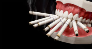 Вплив куріння на здоров’я порожнини рота